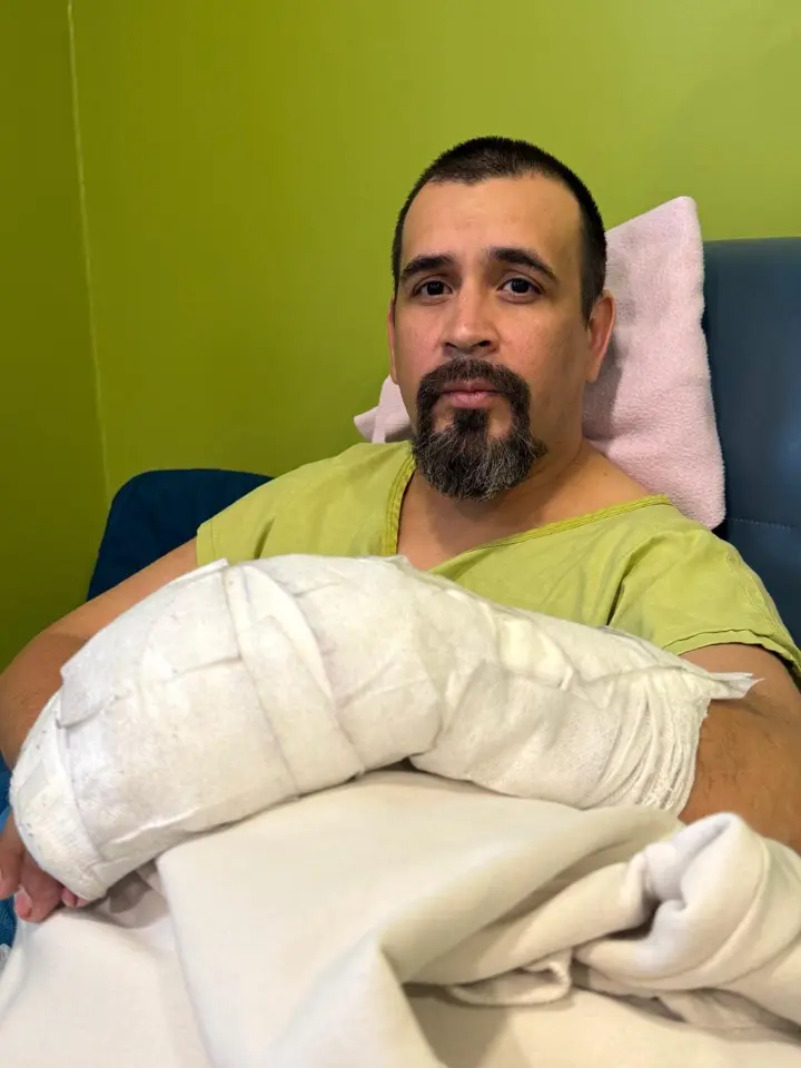 Hospital Puerto Montt salva la mano de un paciente de 39 años con una cirugía de 9 horas, marcando un nuevo hito del equipo de Mano y Muñeca.